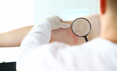 Læge undersøger en patients arm for hudkræft