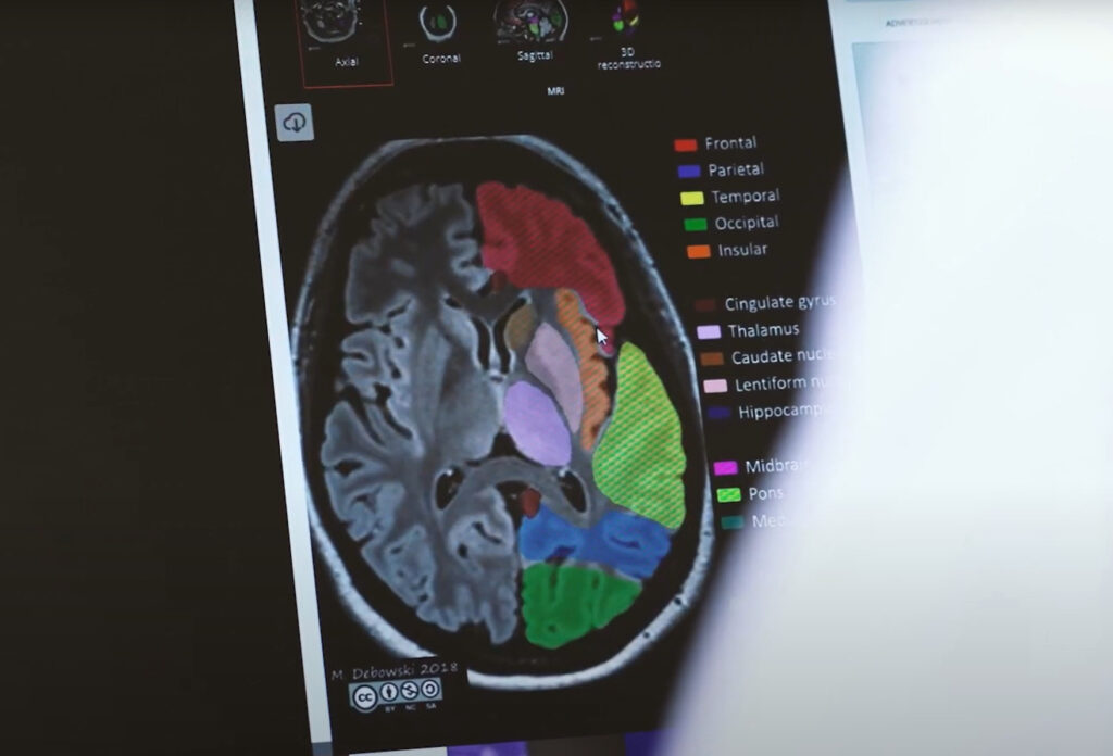 Neurologisk scanning af hjernen