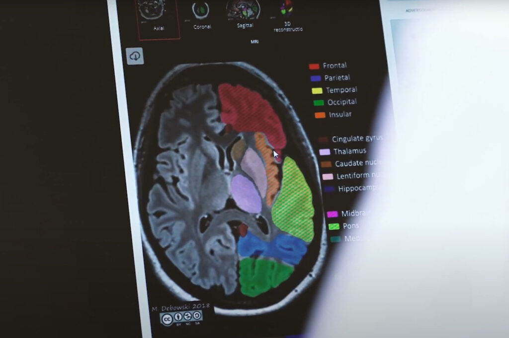 Specialer 16 Neurologisk scanning af hjernen