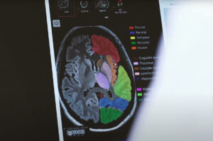 Privathospitalet danmark 9 Neurologisk scanning af hjernen