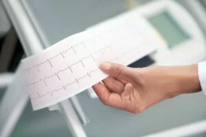 Close up af lægens hånd med elektrokardiogram resultat