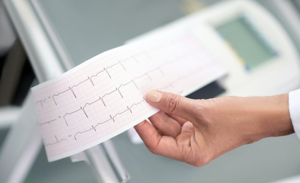 Specialer 11 Close up af lægens hånd med elektrokardiogram resultat
