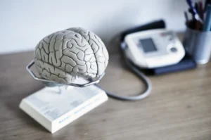 Billede af hjernen, neurologi, epilepsi